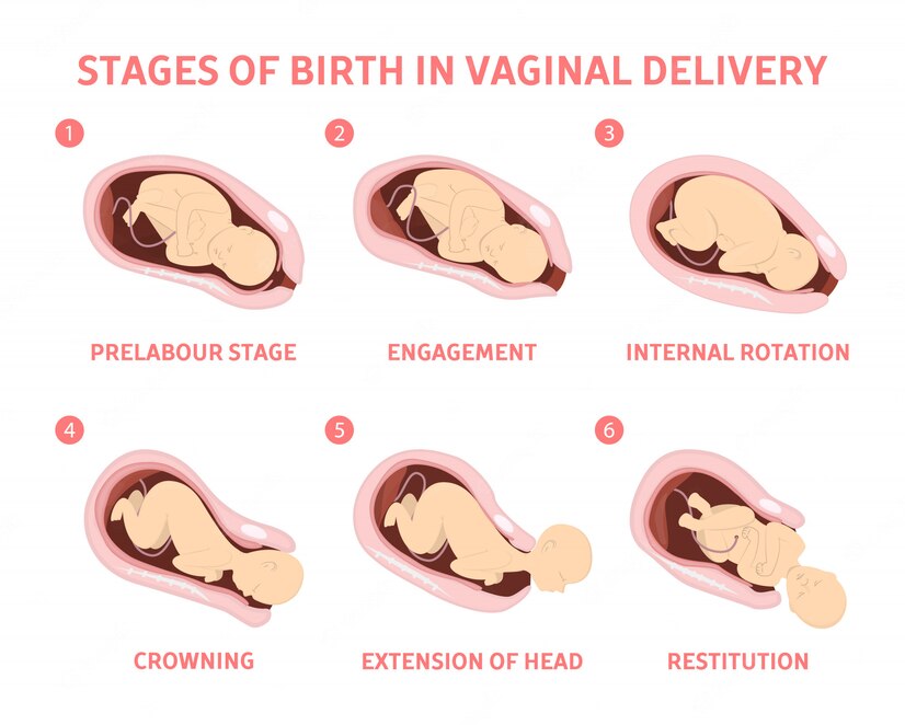 What is Normal Delivery ? || image