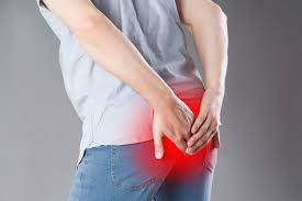 How to Live with Pilonidal Sinus Dos and Donts