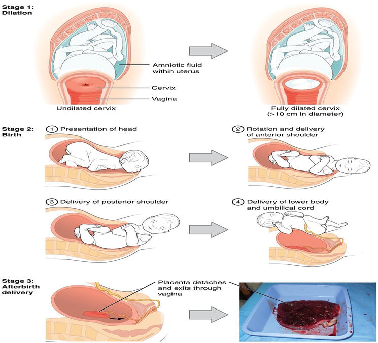 Normal Delivery Procedure || image