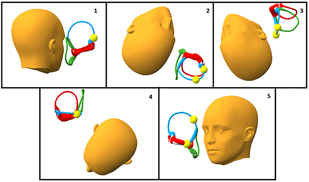Canalith Repositioning Procedure (CRP)