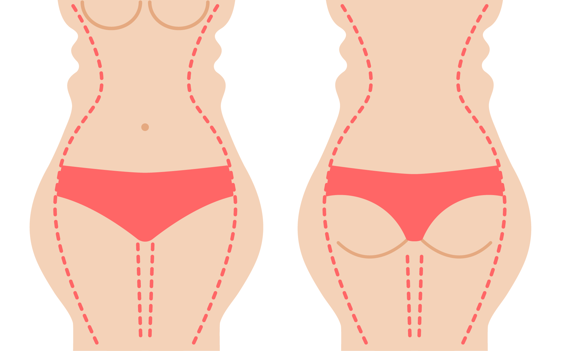 What is Body Sculpting (Body Contouring) || image
