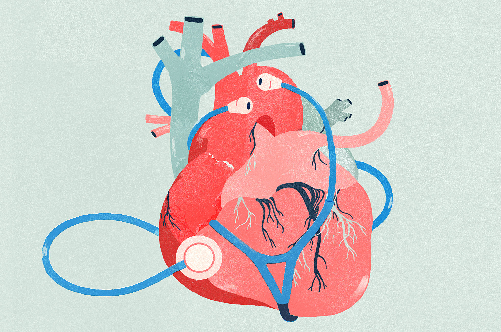 Facts and Statistics About Heart & Bypass Surgery